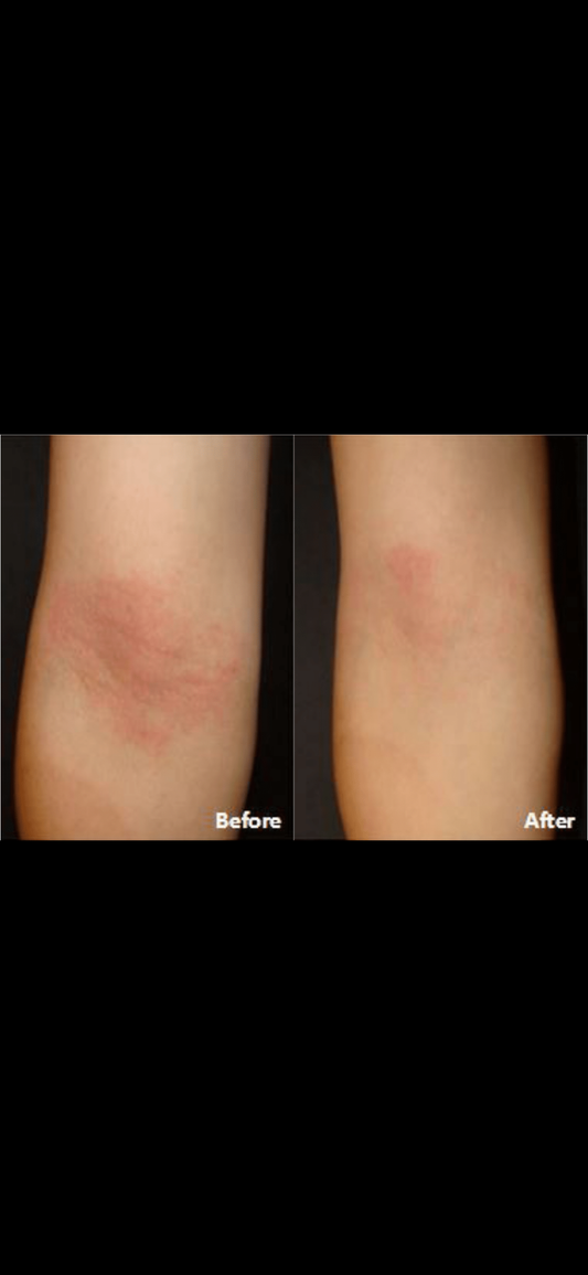 ⭐⭐⭐⭐⭐ Trusted by Real Families
Scroll down to see real results & reviews